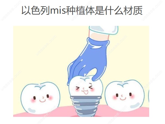 mis种植体是什么材质