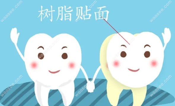 牙齿贴面修复需要磨牙吗m.waasee.com 牙齿贴面修复需要磨牙吗m.waasee.com