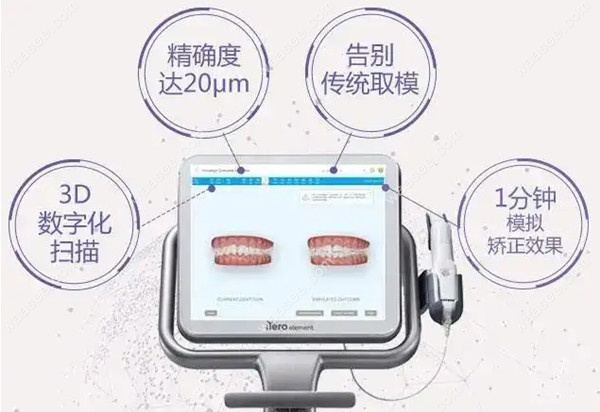 隐适美取模后要等多久才能拿到牙套