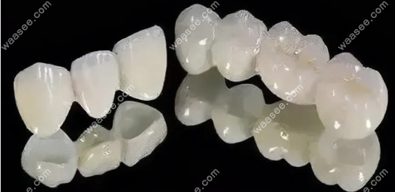 连冠全瓷牙www.waasee.com