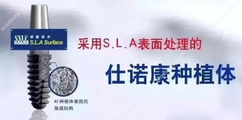韩国仕诺康种植牙介绍