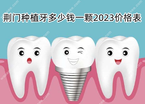 荆门种植牙多少钱一颗2023价格表