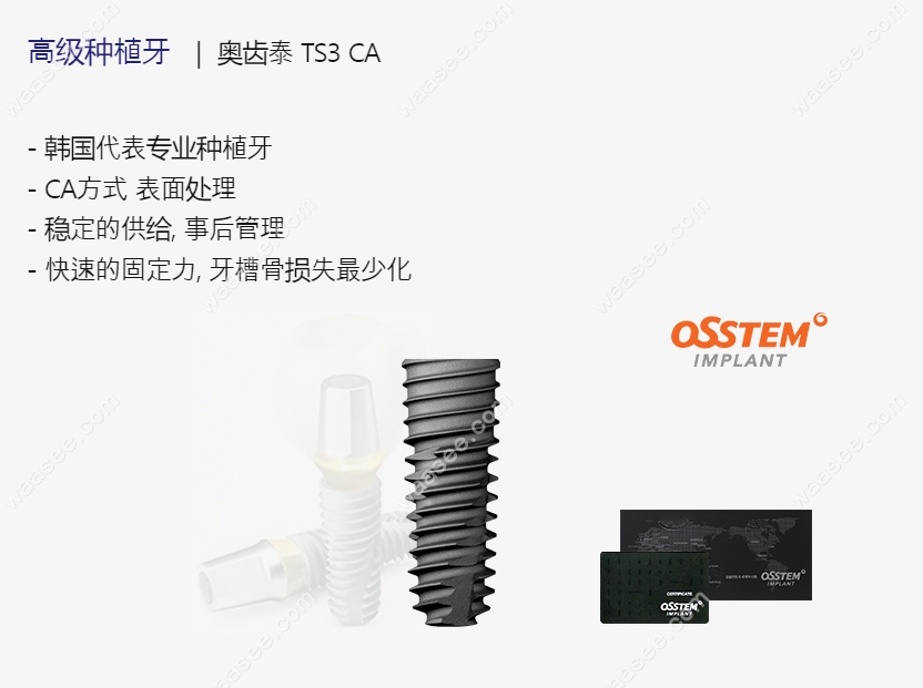 韩国种植牙哪个品牌性价比高www.waasee.com