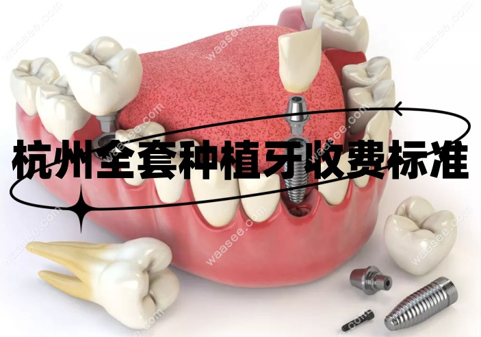杭州全套种植牙收费标准www.waasee.com