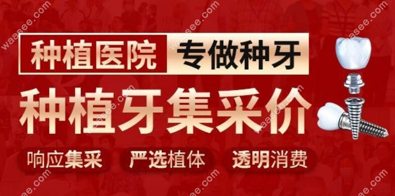 西安团圆口腔种植牙报价价格便宜-牙齿矫正网