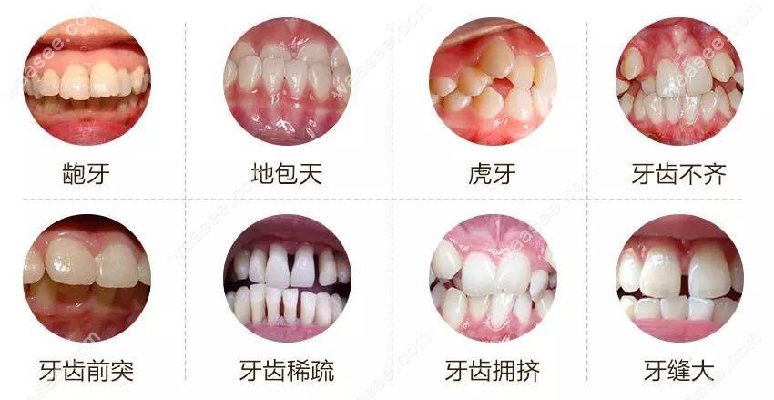 南京博韵口腔医院牙齿矫正价格