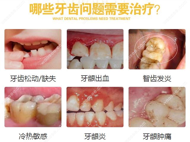 南京博韵口腔医院综合治疗价格waasee.com