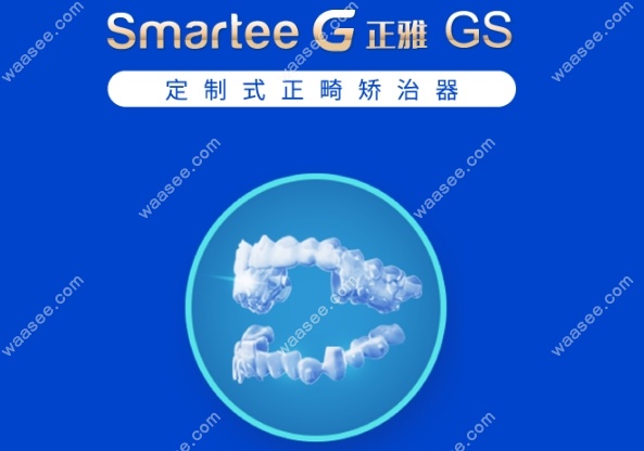 正雅隐形牙套gs版分几个阶段