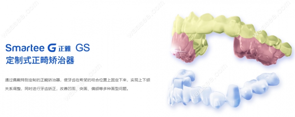 正雅隐形牙齿矫正GS版优点