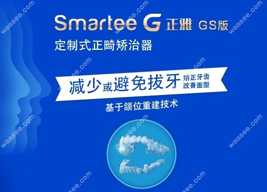 正雅隐形牙套gs版分2个阶段