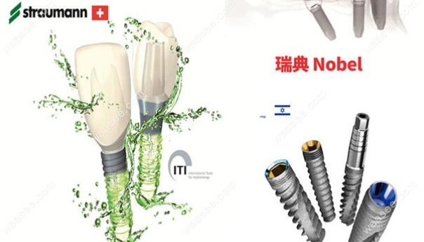 欧美种植体品牌质量都是上佳的
