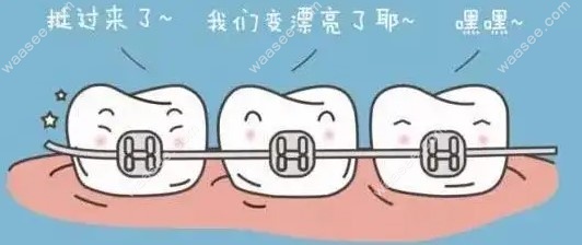 日本拓美金属自锁牙套价格m.waasee.com