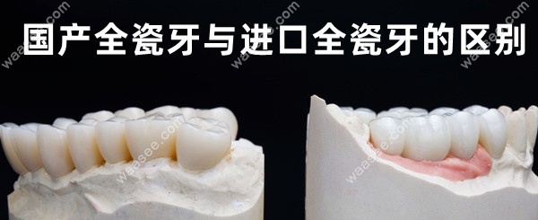 国产全瓷牙与进口全瓷牙的区别:价格/硬度/色泽/寿命差别大