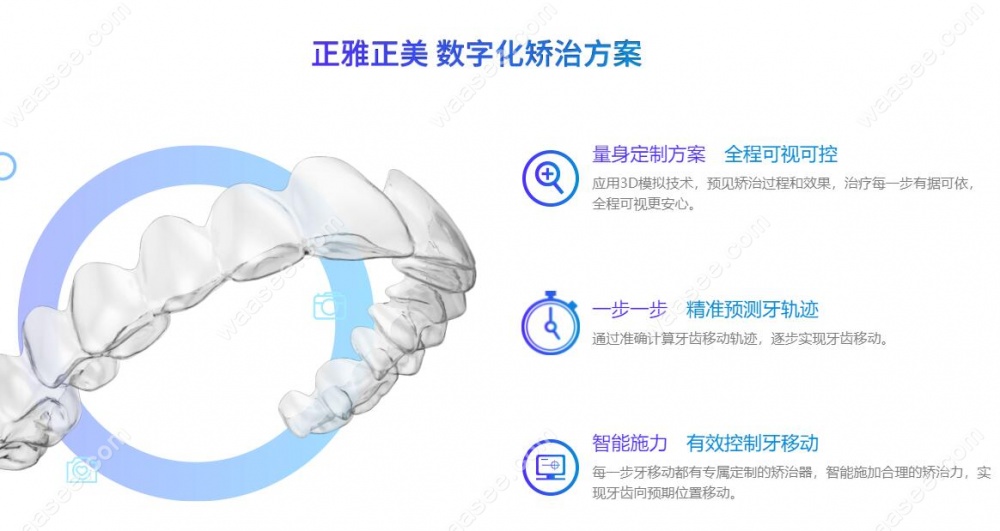 正雅隐形矫正器价格表-牙齿矫正网