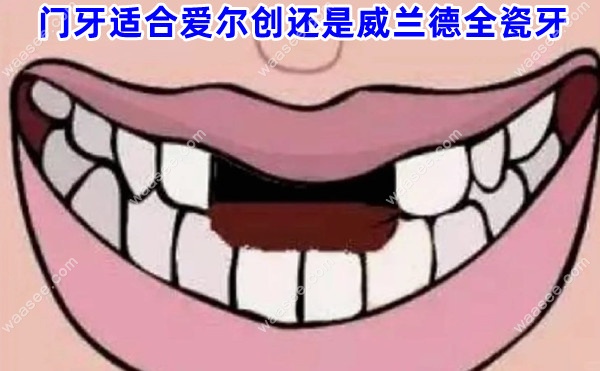 门牙适合爱尔创还是威兰德全瓷牙