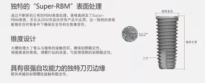 韩国美格真灰色植体