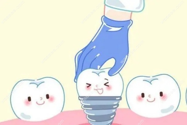 <!--<i data=20240703-sp></i>-->黄浦区种植牙哪家好waasee.com