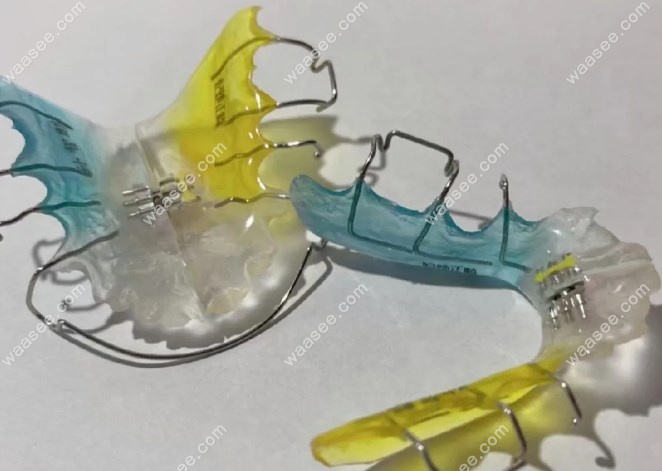 twin block矫治器佩戴时间