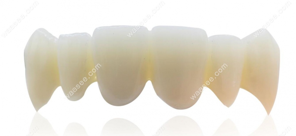国产牙冠和进口牙冠有什么区别-www.waasee.com