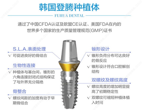 韩国登腾种植牙工艺设计