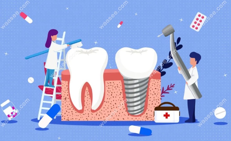 种植牙后需要做一副临时牙吗？一般只有前牙需要做临时牙
