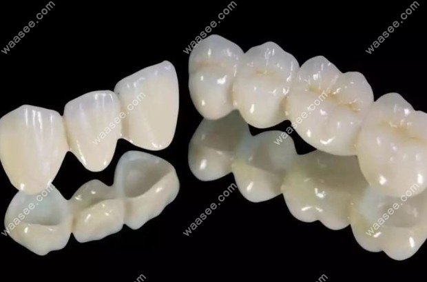 瑞典procera全瓷牙价格