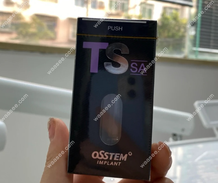 种植牙奥齿泰质量好