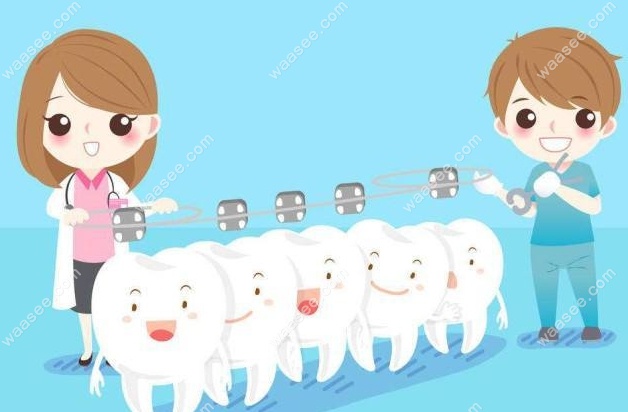 奥美科自锁托槽是美国进口矫治器品牌，技术先进效率高