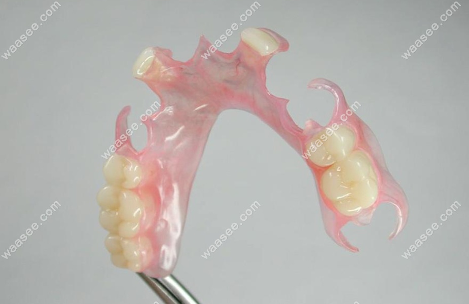 隐形义齿会加速牙槽骨吸收吗~牙齿矫正网