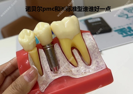 诺贝尔pmc和iti集采后标准型谁好一点