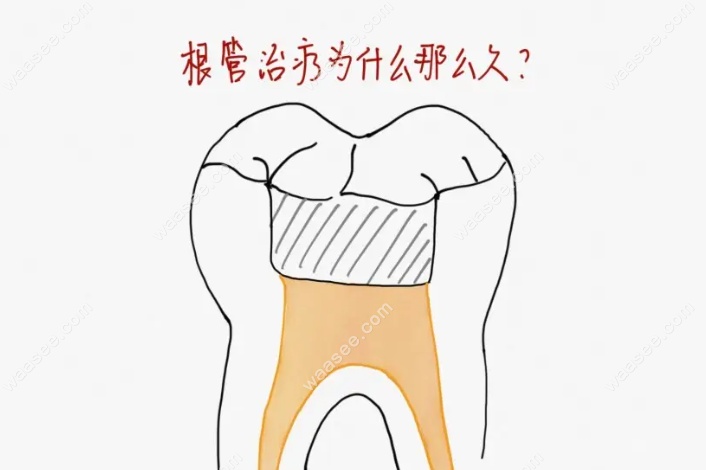 牙神经暴露