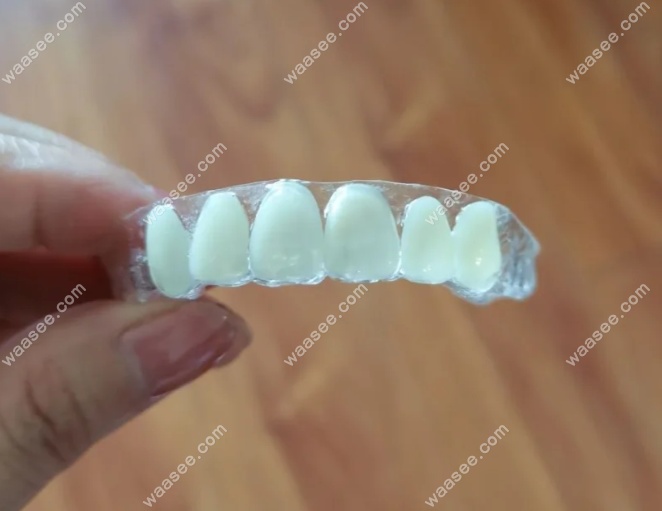 门牙拔了上班难看怎么办