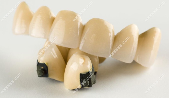 把好的牙磨小做全瓷牙