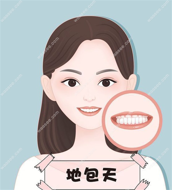 广州成人地包天矫正价格表