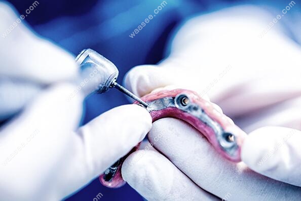 天津海德堡联合口腔医院种植牙修复