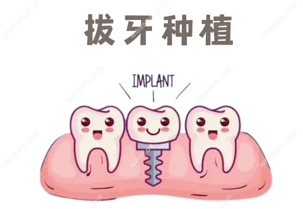 北京微创种植牙哪家医院做的好