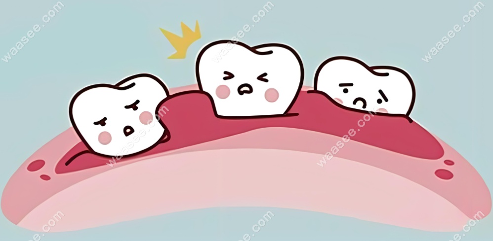 为什么牙齿根尖囊肿拔掉后不能种牙了呢