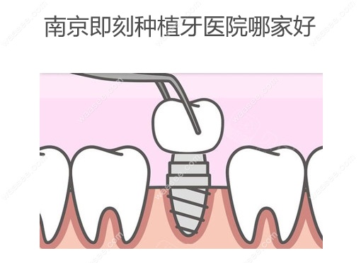 南京即刻种植牙医院哪家好