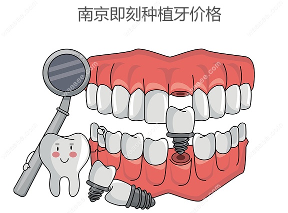 南京即刻种植牙价格www.waasee.com