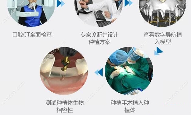 深圳微创种植牙领域拥先进设备的医疗机构