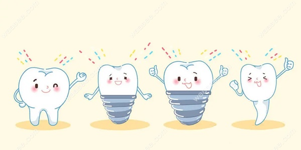 连续多颗、半口、全口牙缺失，一起做种植牙的优势~牙齿矫正网