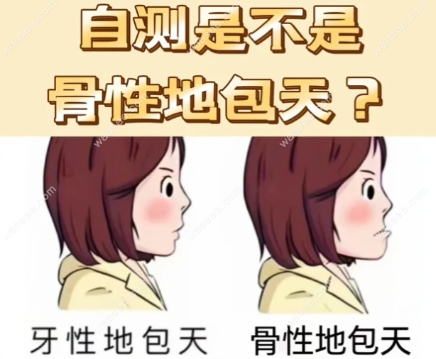 功能性反颌和骨性反颌的鉴别诊断