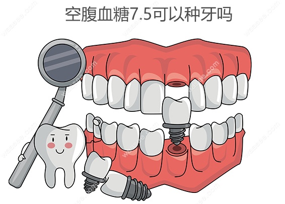 空腹血糖7.5可以种牙吗,不建议,会影响种植牙的成功几率