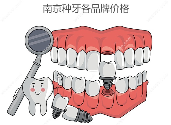 南京种牙各品牌价格,国产种植牙价格3000+进口种植牙4000+