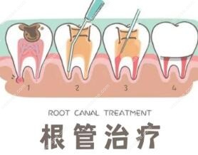 深圳徕可口腔收费价格不贵