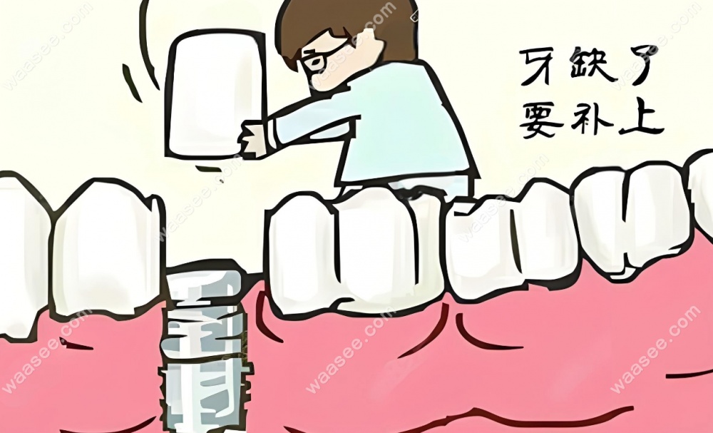北京美冠塔口腔种植牙价格