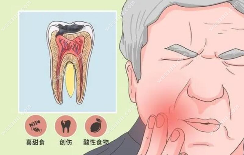 急性牙髓炎牙齿疼痛情况
