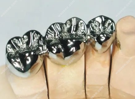 纯钛金属牙冠多少钱一颗？www.waasee.com