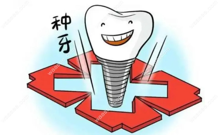 <!--<i data=20240703-sp></i>-->种植牙哪家医院可以用报销