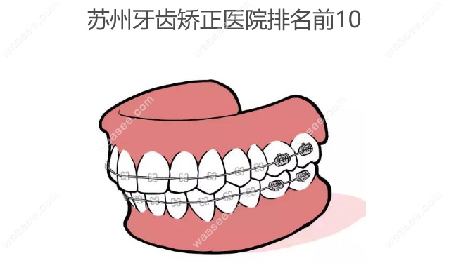 苏州牙齿矫正医院排名前十www.waasee.com